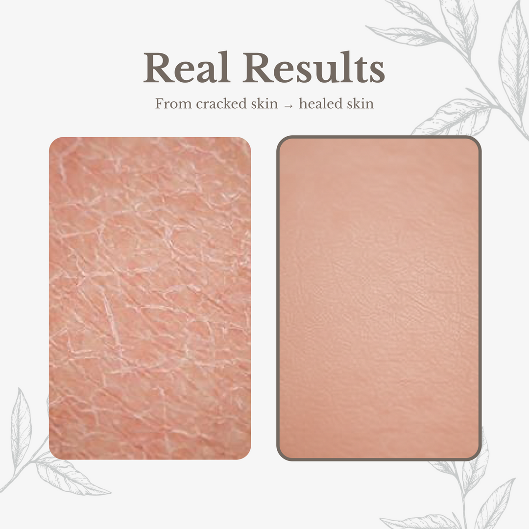 Euphoric Herbals Awesome Salve